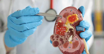 Comprehensive Kidney Disease Management Guide: Evidence-Based Strategies 